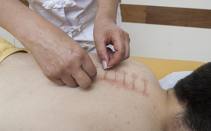 YUCATÁN TENDRÁ UNA LICENCIATURA EN MEDICINA TRADICIONAL CHINA YUCATÁN TENDRÁ UNA LICENCIATURA EN MEDICINA TRADICIONAL CHINA